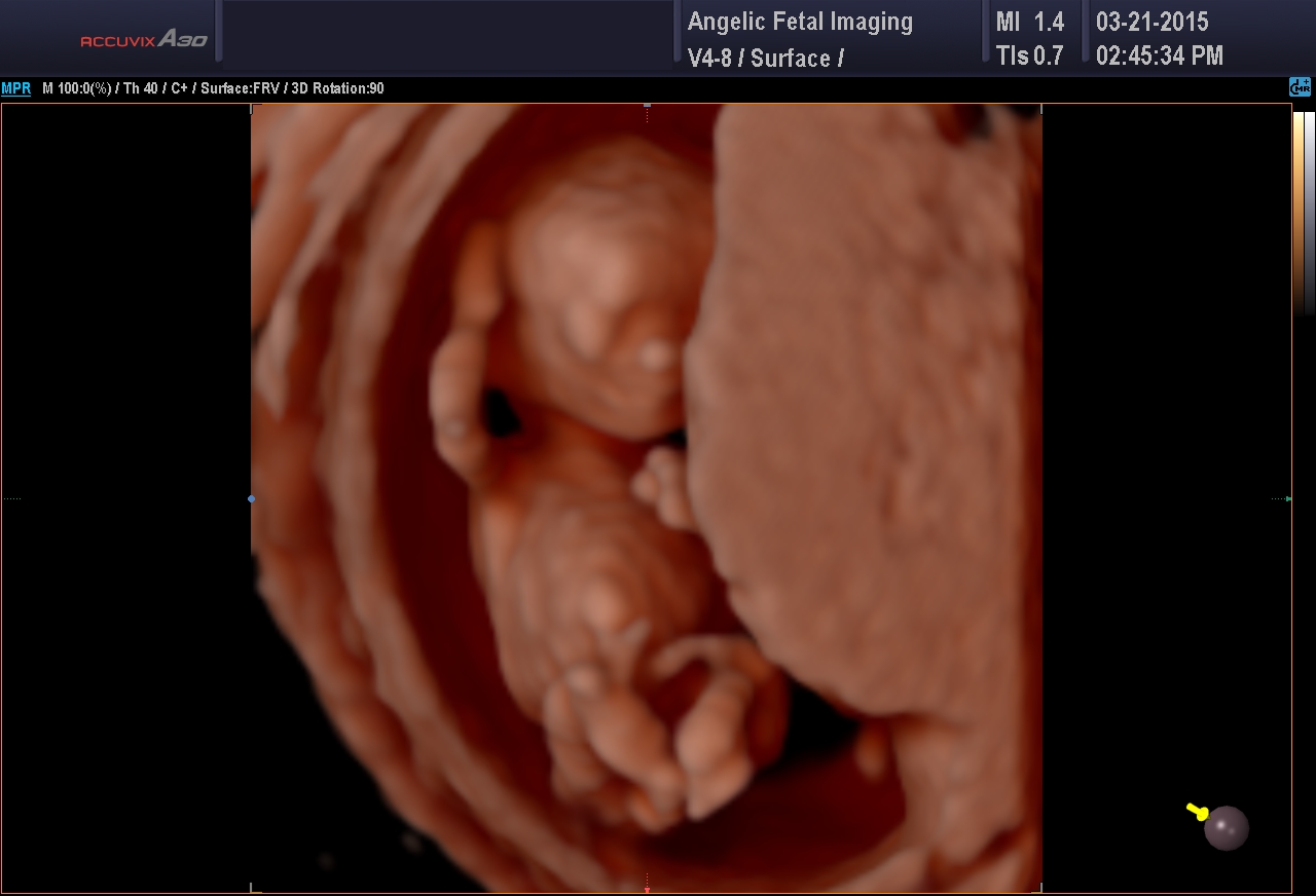 HD Photos | First Trimester